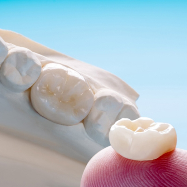 Featured image for “Are One Visit Porcelain Crowns the Right Choice for Your Teeth?”