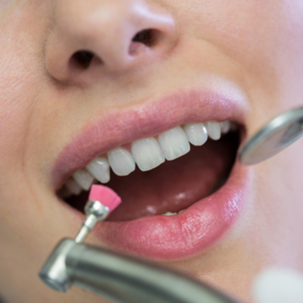 Featured image for “The Biological Impact of Professional Whitening”