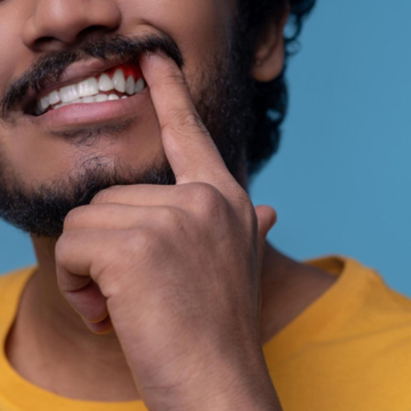 Featured image for “How to Tell if That Bleeding While Brushing Is a Warning Sign”