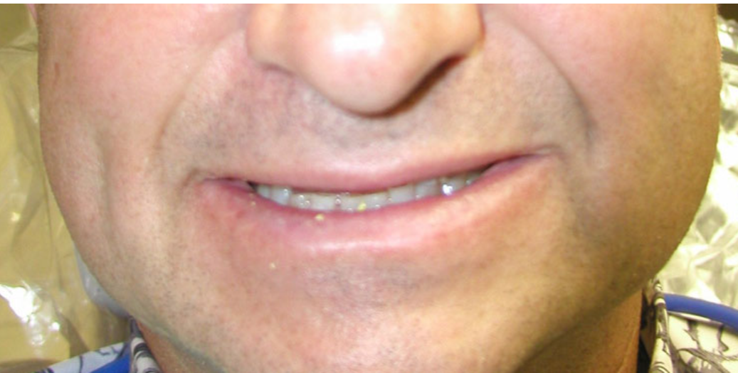 Before dental treatment
