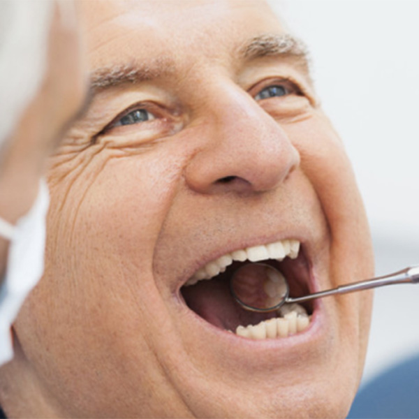 Featured image for “How to Care for Your Dentures”